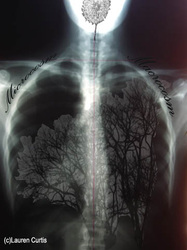 Chest x-ray collaged with photos of tree branches in the lungs and a dandelion in the head area.  Dark tones.